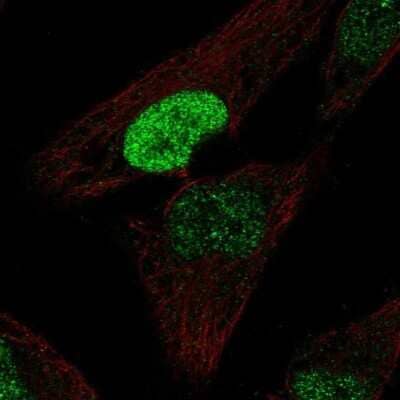 Immunocytochemistry/ Immunofluorescence: PDX-1/IPF1 Antibody [NBP2-38865]