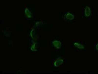 Immunocytochemistry/ Immunofluorescence: PDX-1/IPF1 Antibody (OTI2A12) - Azide and BSA Free [NBP2-73330]