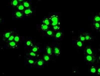 Immunocytochemistry/ Immunofluorescence: PDX-1/IPF1 Antibody (OTI2A12) - Azide and BSA Free [NBP2-73330]