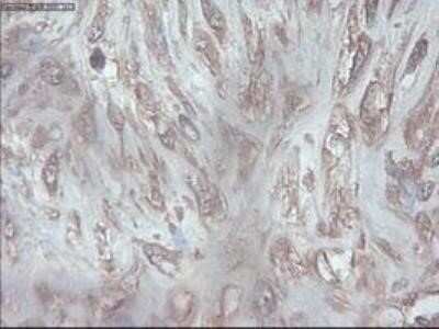 Immunohistochemistry: PDX-1/IPF1 Antibody (OTI2A12) - Azide and BSA Free [NBP2-73330]