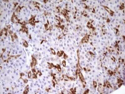 Immunohistochemistry: PDX-1/IPF1 Antibody (OTI3H3) - Azide and BSA Free [NBP2-73332]