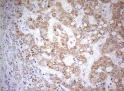 Immunohistochemistry: PDX-1/IPF1 Antibody (OTI3H3) - Azide and BSA Free [NBP2-73332]