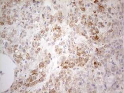 Immunohistochemistry: PDX-1/IPF1 Antibody (OTI3H3) - Azide and BSA Free [NBP2-73332]