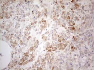 Immunohistochemistry-Paraffin: PDX-1/IPF1 Antibody (OTI3H3) [NBP2-46371]