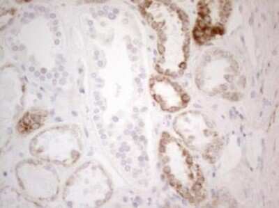 Immunohistochemistry-Paraffin: PDX-1/IPF1 Antibody (OTI3H3) [NBP2-46371]