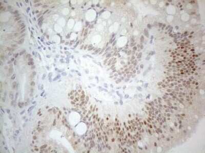 Immunohistochemistry-Paraffin: PDX-1/IPF1 Antibody (OTI3H3) [NBP2-46371]