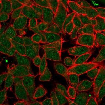 Immunocytochemistry/ Immunofluorescence: PDX-1/IPF1 Antibody (PCRP-PDX1-2C11) [NBP3-07528]