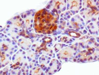 Immunohistochemistry: PDX-1/IPF1 Antibody - BSA Free [NBP2-22150]