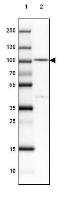 Western Blot: PDXDC1 Antibody [NBP2-30594]