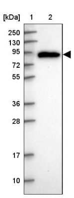 Western Blot: PDXDC1 Antibody [NBP2-47336]