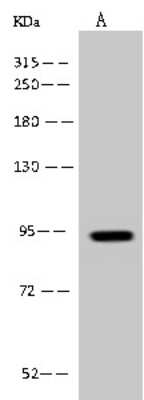 Western Blot: PDXDC1 Antibody [NBP2-97693]