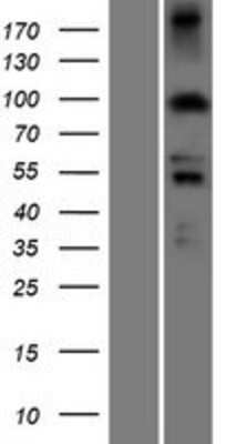 Western Blot: PDXDC1 Overexpression Lysate [NBP2-07220]