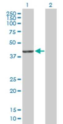 Western Blot: PDXDC2 Antibody [H00283970-B01P]