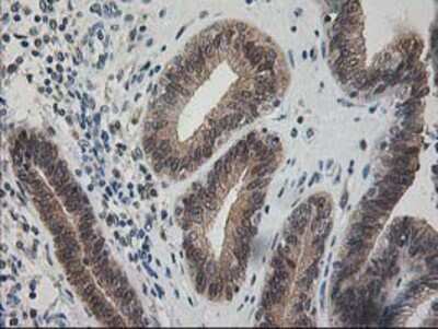 Immunohistochemistry-Paraffin: Pyridoxal Kinase/PDXK Antibody (OTI5H5) [NBP2-00821]