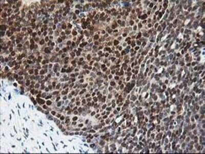 Immunohistochemistry-Paraffin: Pyridoxal Kinase/PDXK Antibody (OTI5H5) [NBP2-00821]