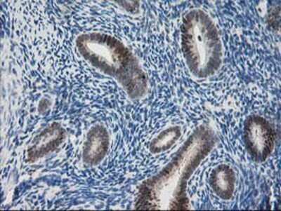 Immunohistochemistry-Paraffin: Pyridoxal Kinase/PDXK Antibody (OTI5H5) [NBP2-00821]