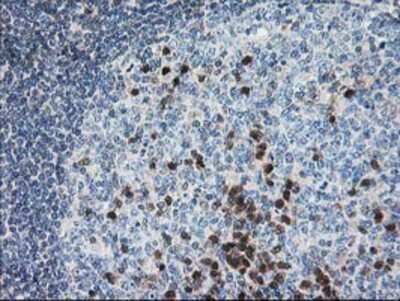 Immunohistochemistry-Paraffin: Pyridoxal Kinase/PDXK Antibody (OTI5H5) [NBP2-00821]