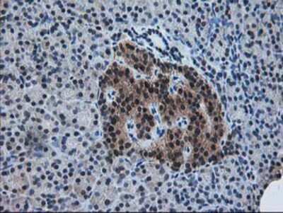 Immunohistochemistry-Paraffin: Pyridoxal Kinase/PDXK Antibody (OTI5H5) [NBP2-00821]