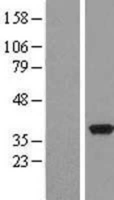 Western Blot: Pyridoxal Kinase/PDXK Overexpression Lysate [NBL1-14267]