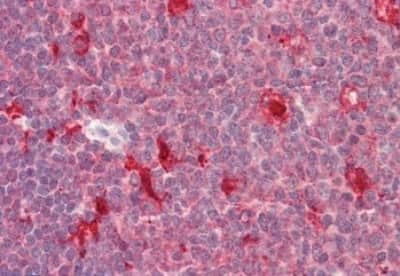 Immunohistochemistry-Paraffin: PDXP Antibody [NBP2-27461]