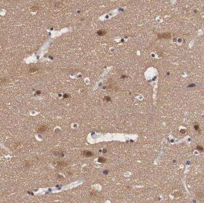 Immunohistochemistry-Paraffin: PDXP Antibody [NBP2-48487]