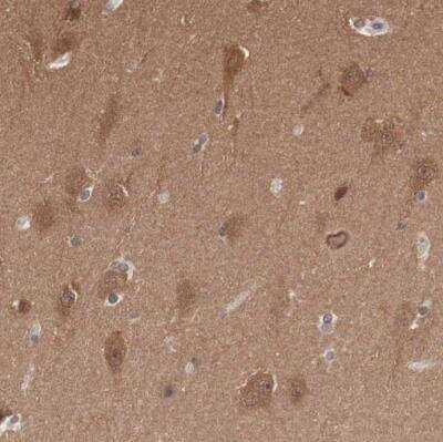 Immunohistochemistry-Paraffin: PDXP Antibody [NBP2-48487]