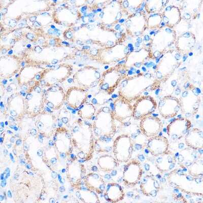 Immunohistochemistry-Paraffin: PDXP Antibody - Azide and BSA Free [NBP2-93574]