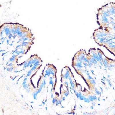 Immunohistochemistry-Paraffin: PDXP Antibody - Azide and BSA Free [NBP2-93574]