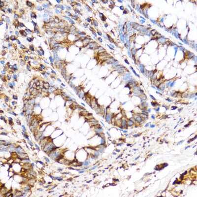 Immunohistochemistry-Paraffin: PDXP Antibody - Azide and BSA Free [NBP2-93574]