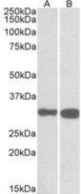 Western Blot: PDXP Antibody [NBP2-27461]