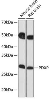 Western Blot: PDXP AntibodyAzide and BSA Free [NBP2-93574]