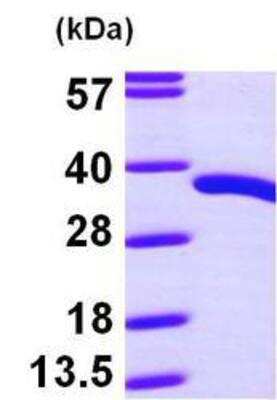 Western Blot: Recombinant Human PDXP His Protein [NBP1-45304]