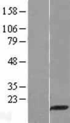 Western Blot: PDZD11 Overexpression Lysate [NBL1-14269]