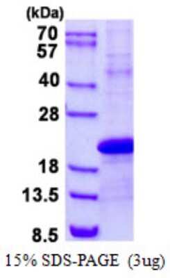 SDS-PAGE: Recombinant Human PDZD11 His Protein [NBP2-23319]