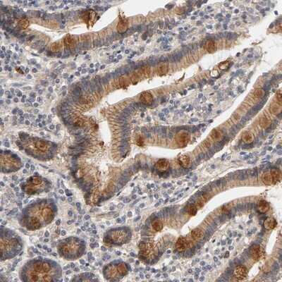 Immunohistochemistry-Paraffin: PDZD11 Antibody [NBP1-80932]