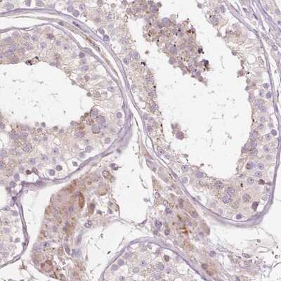 Immunohistochemistry-Paraffin: PDZD2/PDZK3 Antibody [NBP2-38305]