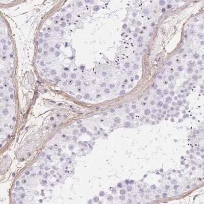 Immunohistochemistry-Paraffin: PDZD2/PDZK3 Antibody [NBP2-39026]