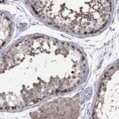 Immunohistochemistry-Paraffin: PDZD2/PDZK3 Antibody [NBP3-17289]