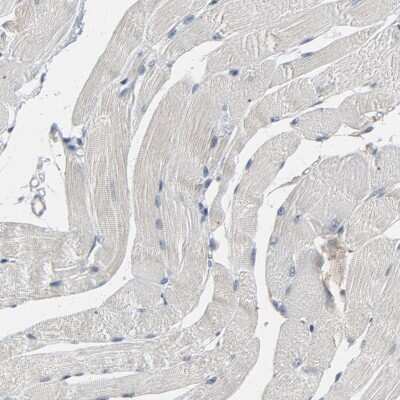 Immunohistochemistry-Paraffin: PDZD4 Antibody [NBP1-93845]