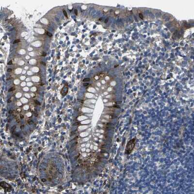 Immunohistochemistry-Paraffin: PDZD8 Antibody [NBP1-88975]