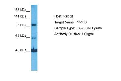 Western Blot: PDZD8 Antibody [NBP2-88027]