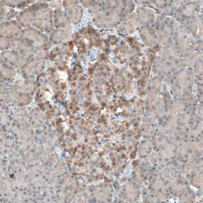 Immunohistochemistry-Paraffin: PDZK1 Antibody [NBP1-82572]