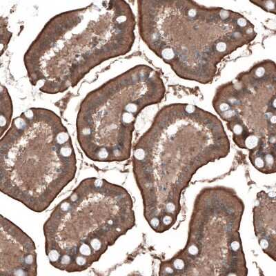 Immunohistochemistry-Paraffin: PDZK1 Antibody [NBP1-82572]