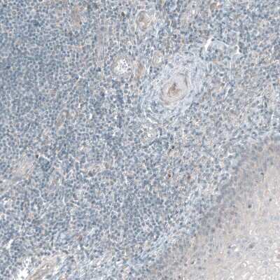 Immunohistochemistry-Paraffin: PDZK1 Antibody [NBP1-82572]