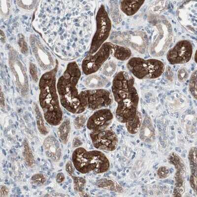 Immunohistochemistry-Paraffin: PDZK1 Antibody [NBP1-82573]