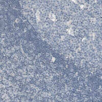Immunohistochemistry-Paraffin: PDZK1 Antibody [NBP1-82573]