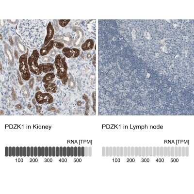 Immunohistochemistry-Paraffin: PDZK1 Antibody [NBP1-82573]