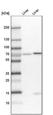Western Blot: PDZK1 Antibody [NBP1-82572]