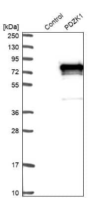 Western Blot: PDZK1 Antibody [NBP1-82573]