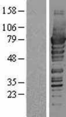 Western Blot: PDZK1 Overexpression Lysate [NBP2-04231]